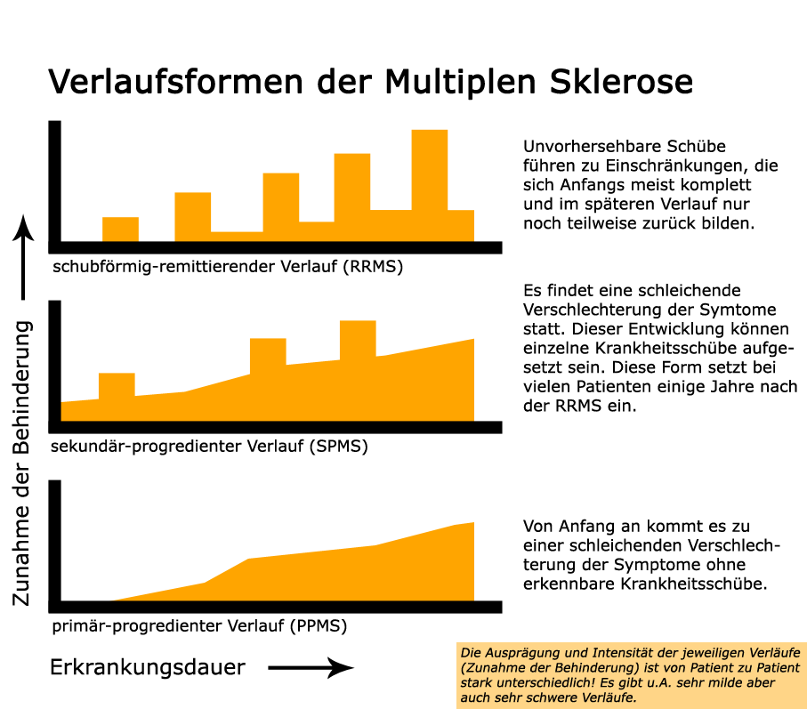 Verlaufsformen MS